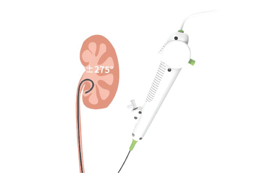 Single-use Digital Flexible Ureteroscope (8.5Fr)