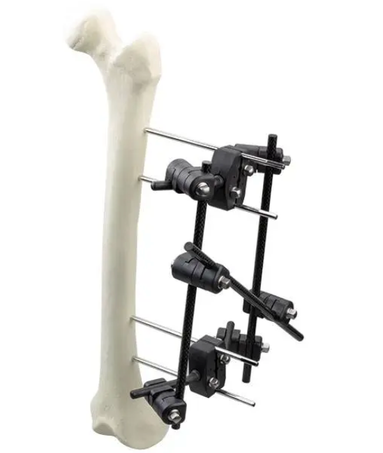 Φ8.0 Series External Fixation Fixator – Femoral Unilateral Reinforcement Frame