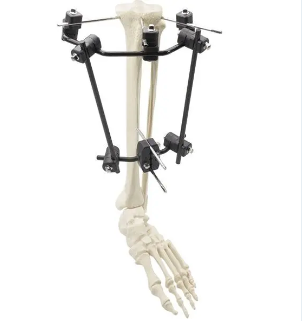 Φ8.0 Series External Fixation Fixator – Proximal Tibia Semicircular Frame