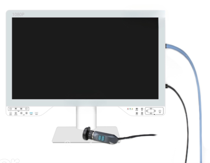 All-in-One Endoscopy System – Light Source, Recorder & Display