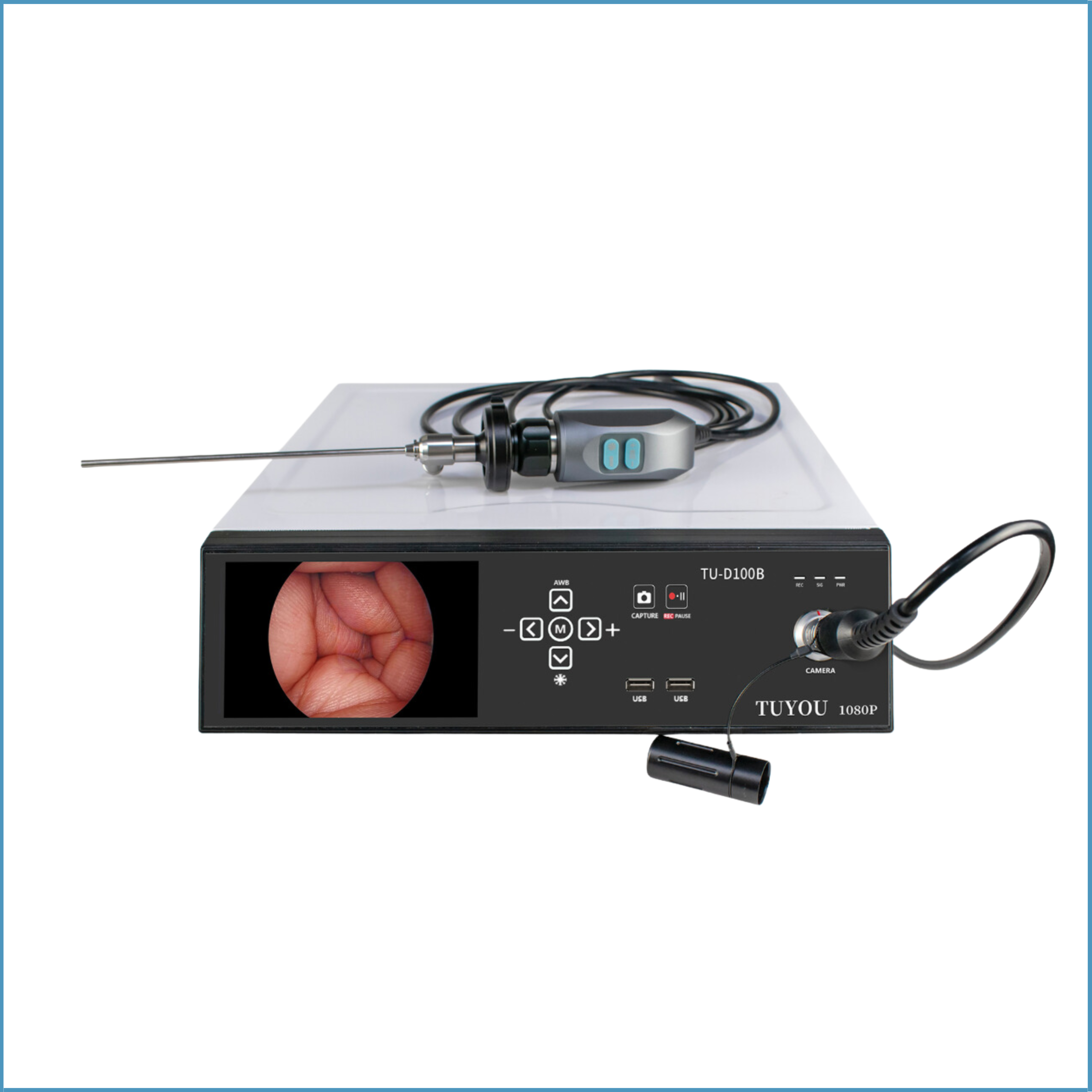 Endoscope Video