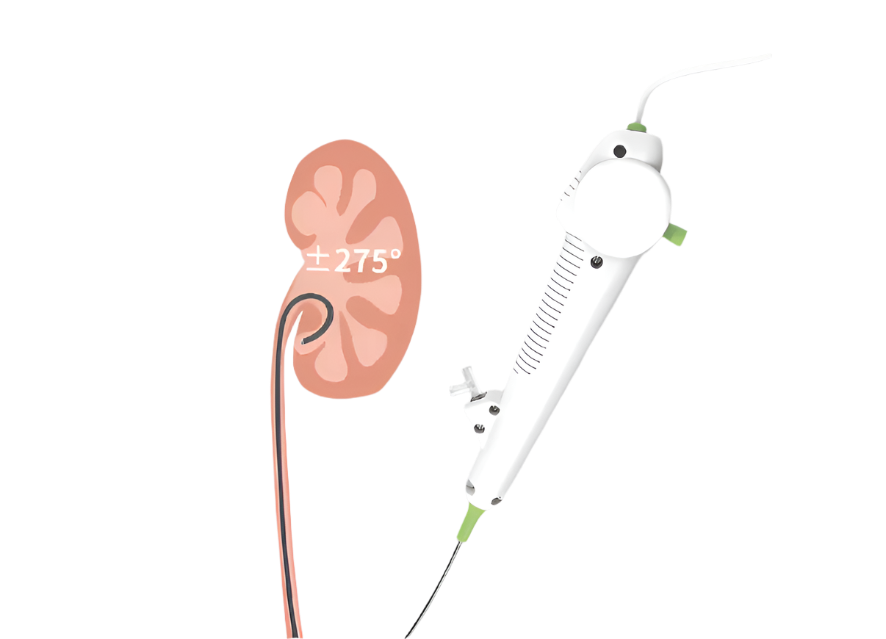 Ureteroscópio Digital Flexível de Uso Único (7,5 Fr)