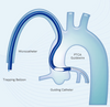 Trapping balloon Catheter