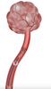 Balloon Occlusion Microcatheter