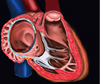 Steerable Duo-decapolar Mapping Catheter